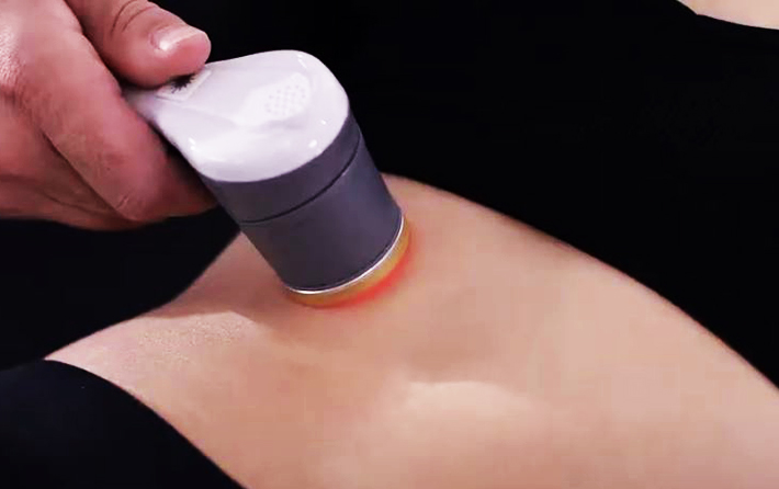 Patient being treated with laser therapy